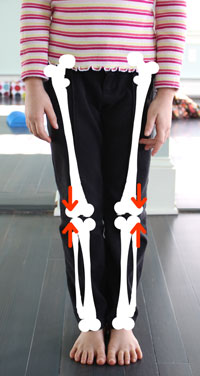 forces on bone in narrow stance